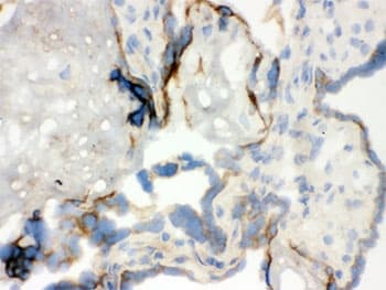 WAS / WASP Antibody