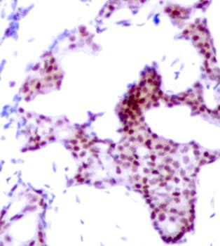Polyclonal Rabbit anti-Human RELA / NFKB p65 Antibody (phospho-Ser276, IHC, IF, WB)