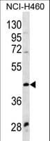 Polyclonal Rabbit anti-Human WNT14 / WNT9A Antibody (aa216-244, WB)