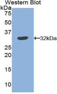 SERPINB2 / PAI-2 Antibody (aa68-313, Biotin)