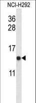 UQCRB Antibody (aa19-47)