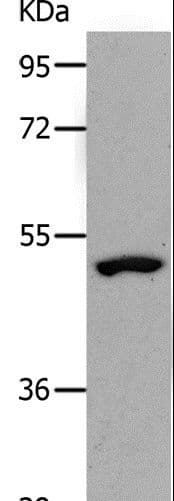 Polyclonal Rabbit anti-Human NDRG1 Antibody (IHC, WB)