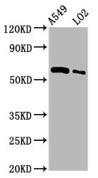 Polyclonal Rabbit anti-Human PARP3 Antibody (IHC, WB)