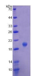 Human CHGA / Chromogranin A Protein (Recombinant His, N-Terminal)