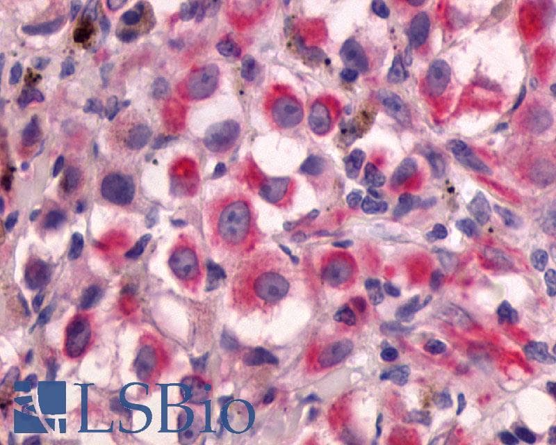 PathPlus™ ADGRG2 / GPR64 Antibody (C-Terminus)