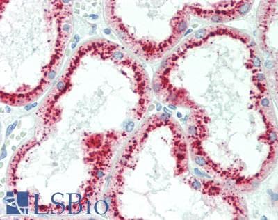 IHC-plus™ Ribonuclease A / RNASE1 Antibody (aa14-42)