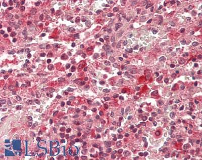 IHC-plus™ Polyclonal Rabbit anti-Human IL17A Antibody (IHC, WB)