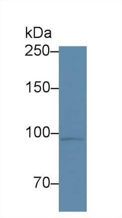 CORIN Antibody (aa70-136)