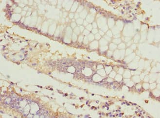 Polyclonal Rabbit anti-Human ICAM4 / CD242 Antibody (IHC, WB)