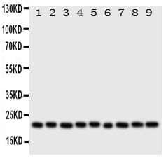 CYGB / Cytoglobin Antibody (aa50-68)