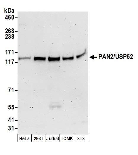 PAN2 / USP52 Antibody (aa1-50)