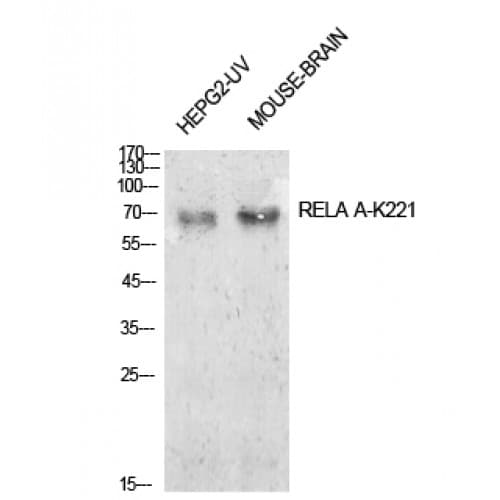 RELA / NFKB p65 Antibody (Internal)