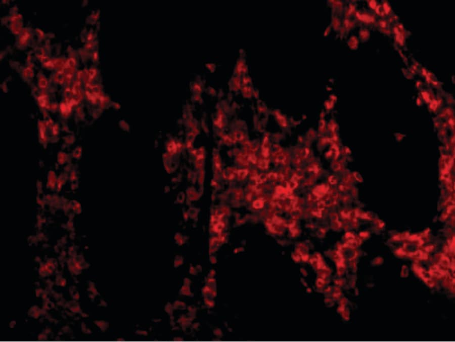 PathPlus™ HTRA2 / OMI Antibody