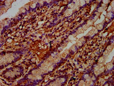 Polyclonal Rabbit anti-Human REG4 / REG-IV Antibody (IHC)