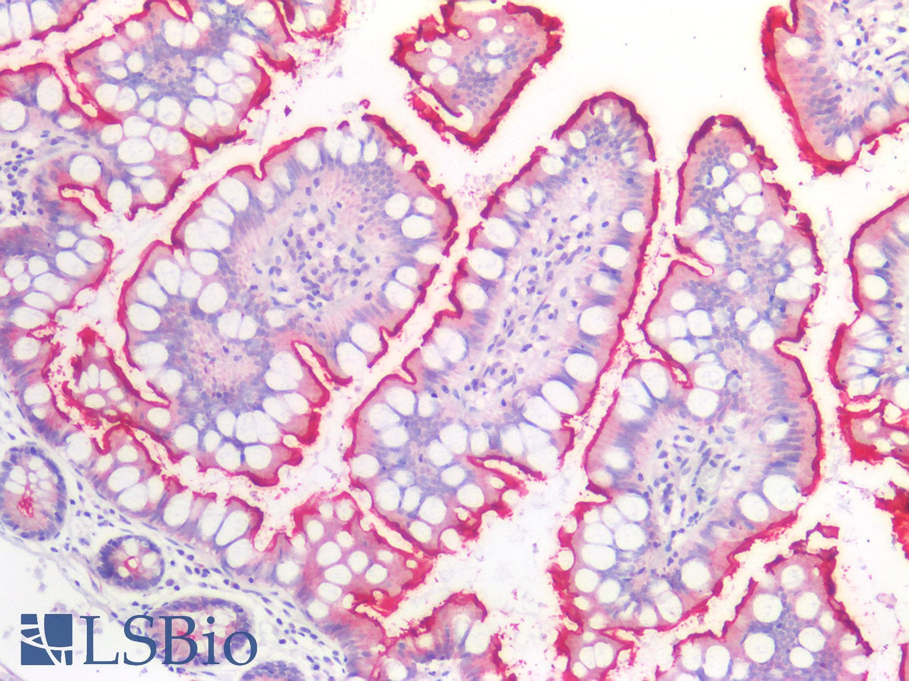 PathPlus™ ENPEP / Aminopeptidase A Antibody (clone OTI1C4)