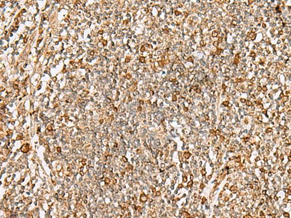 Thymidylate Kinase Antibody