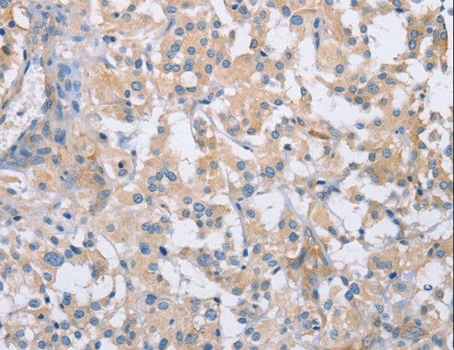 CDCP1 Antibody