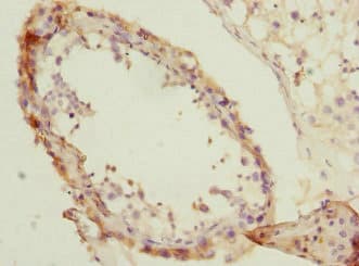 Polyclonal Rabbit anti-Human NMT2 Antibody (IHC, WB)