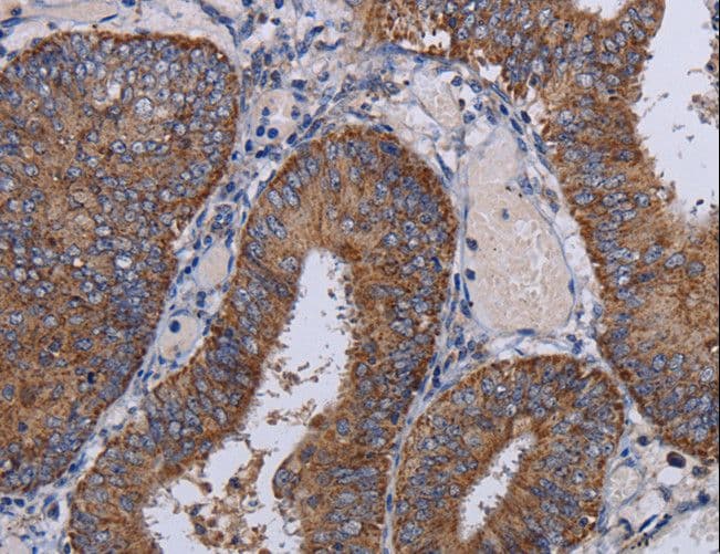 NDUFA1 Antibody