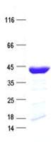 Human AIMP1 / EMAP II Protein (Recombinant His, N-Terminal)