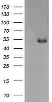 IHC-plus™ MDM4 / MDMX Antibody (clone 4G5)
