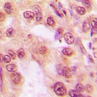 PSMC5 / SUG1 Antibody