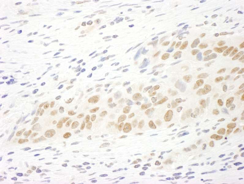 MASTL / GW Antibody (aa550-600)