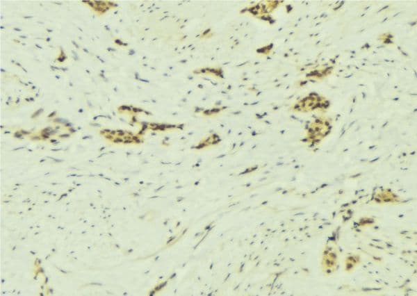 NAP1L1 Antibody