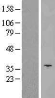 Human SLC25A14 / UCP5 Protein (Over-Expression Lysate Myc-DDK (Flag))