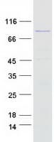 Human MSH5 Protein (Recombinant Myc-DDK (Flag))