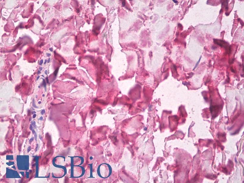 IHC-plus™ COL5A1 / Collagen V Alpha 1 Antibody (clone 6A7)