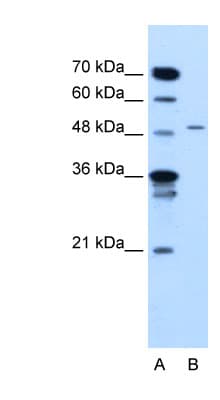 Polyclonal Rabbit anti-Human TYRP1 / gp75 Antibody (FITC, aa151-200, WB)