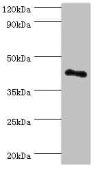 VIPERIN / RSAD2 Antibody (aa42-361)
