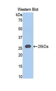 ACAN / Aggrecan Antibody (aa2162-2316)