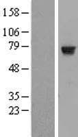 TRMT2A Protein (Over-Expression Lysate Myc-DDK (Flag))