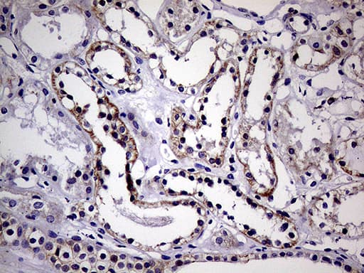 SEMA4D / Semaphorin 4D / CD100 Antibody (clone OTI8F1)