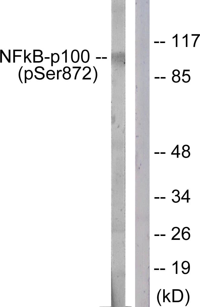 NFKB2 Antibody (phospho-Ser872)