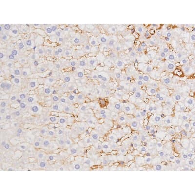 Polyclonal Rabbit anti-Human MAPT / Tau Antibody (phospho-Thr212, IHC, WB)