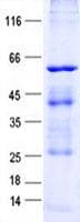 Human GLIS2 Protein (Recombinant His, N-Terminal)