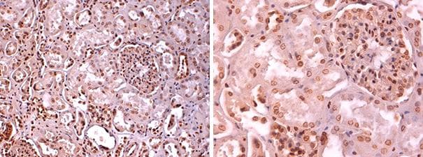 LGALS12 / Galectin 12 Antibody