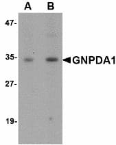 IHC-plus™ GNPDA1 Antibody