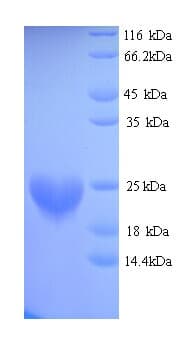 Mouse CENPA / CENP-A Protein (Recombinant His)