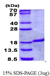 Human IRGM / LRG-47 Protein (Recombinant His)