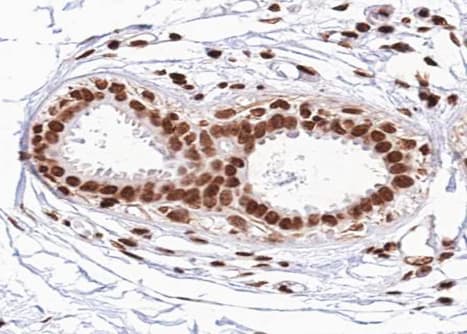 FOXO1 / FKHR Antibody (phospho-Ser329)