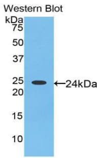 THBS1 / Thrombospondin-1 Antibody (aa24-221, Biotin)