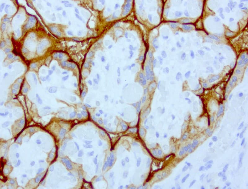 EGFR Antibody (clone UMAB95)