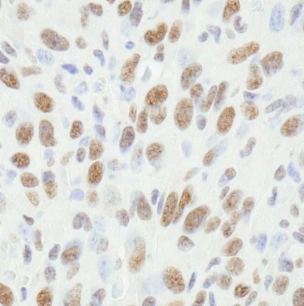 FUS / TLS Antibody (aa1-50)