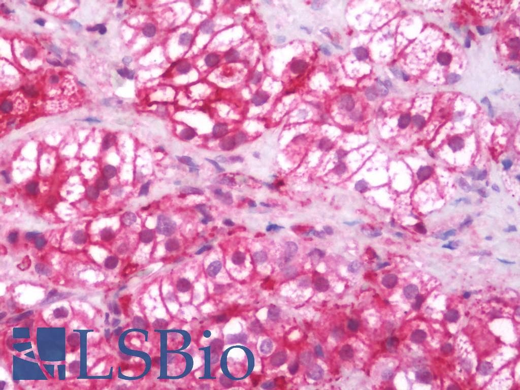 IHC-plus™ Polyclonal Rabbit anti-Human RDX / Radixin Antibody (aa95-434, IHC, WB)