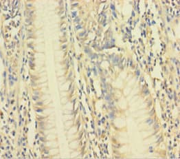 VAMP5 / VAMP-5 Antibody