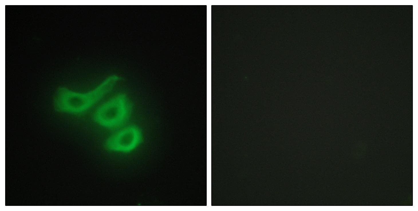 CKM / Creatine Kinase MM Antibody